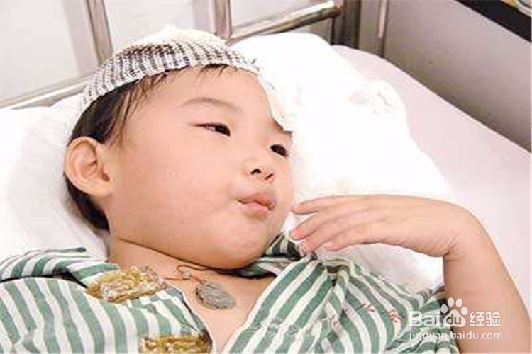 在幼儿园摔伤额头怎么赔偿