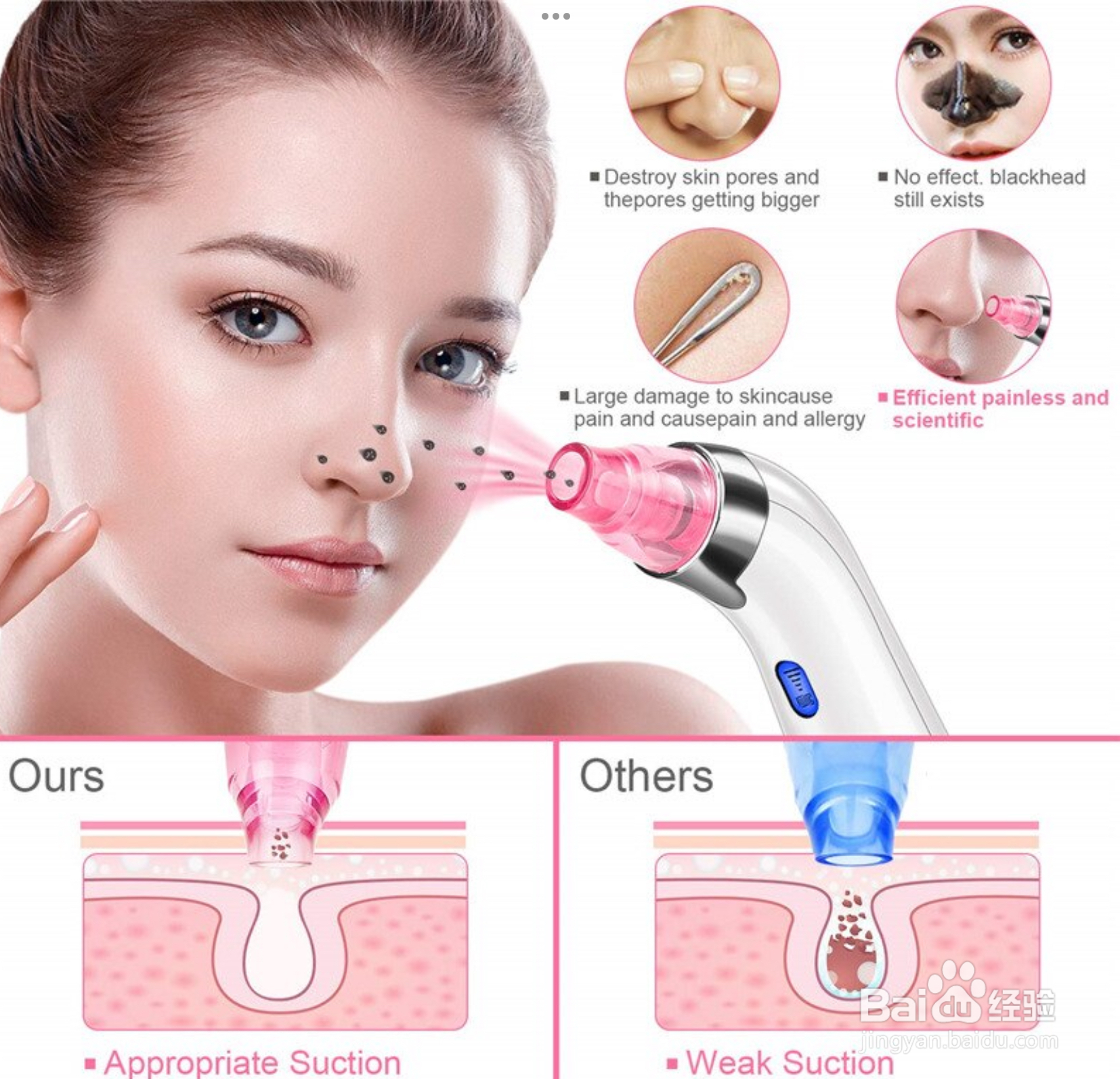 黑头粉刺很多怎么办?