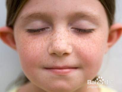 脸上长斑的祛斑方法