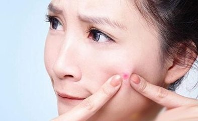去痘痘最有效方法