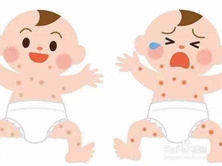 皮肤瘙痒起红疙瘩,怎么办?