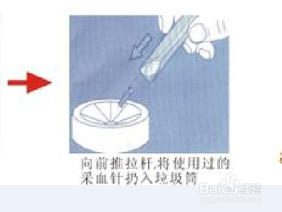 采血针的使用方法图解