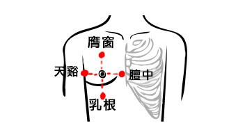哺乳期乳腺炎艾灸有用吗?艾灸效果分享附穴位!