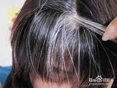 小偏方，治白发