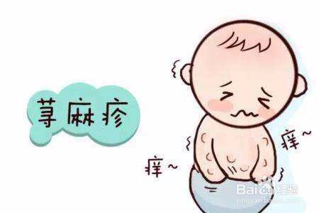 小儿荨麻疹该如何护理?