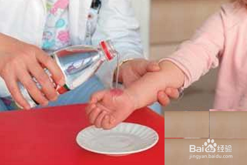 小孩伤口怎样预防疤痕?
