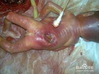 如何预防胎儿先天性畸形