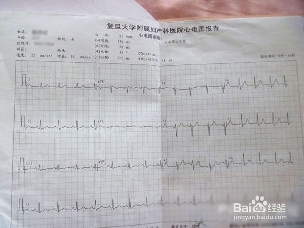 上海红房子建大卡流程
