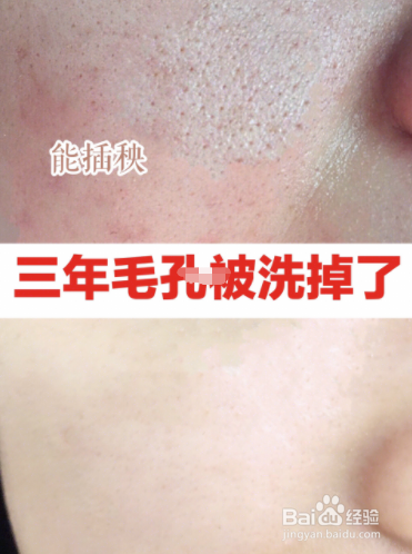 毛孔堵塞怎么办？
