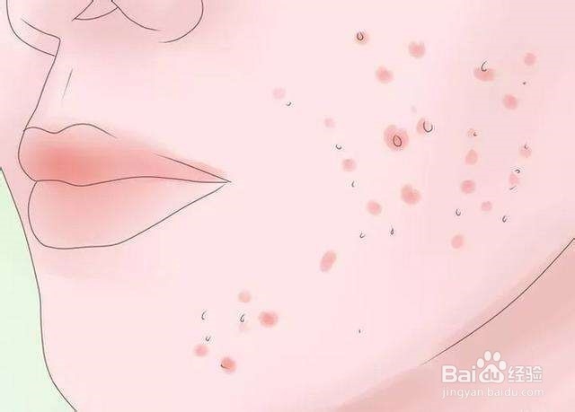 小孩长扁平忧怎么办