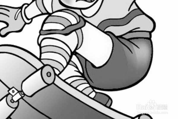 是什么导致腰椎间盘突出复发