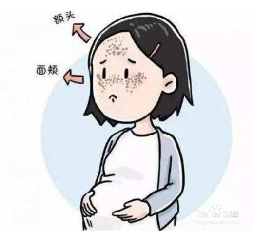 什么牌子的孕妇护肤品好 护肤品怎么选择