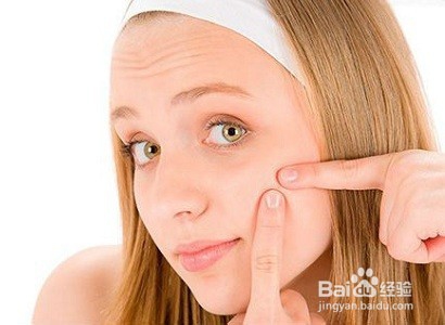 脸上总是长痘痘的四个因素