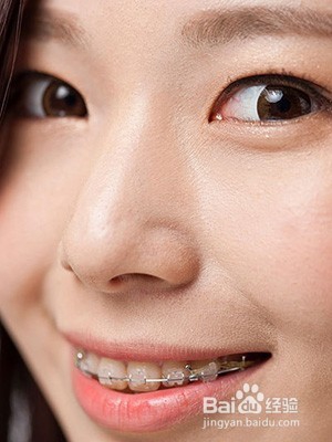 关于牙齿正畸你需要知道的5件事