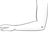 高血压如何降压偏方,高血压如何降压穴位