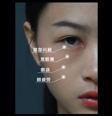 眼膜宽一头窄一头怎么贴