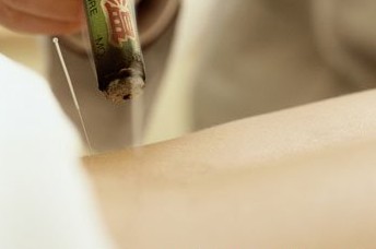 怎样去除黑眼圈？？？