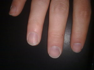 指甲的物理性质