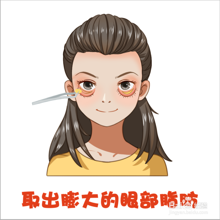 什么是割眼袋有什么危害