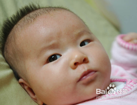 婴儿长湿疹怎么办