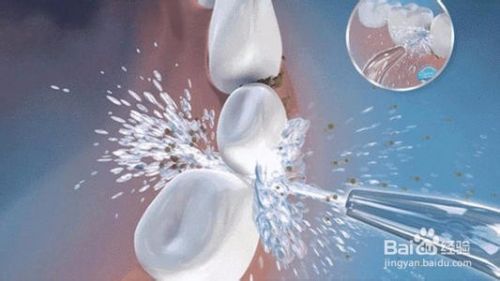 合肥洗牙费用多少钱一次洗牙价格表 百度经验