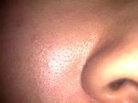 怎么知道自己的肤质是什么类型