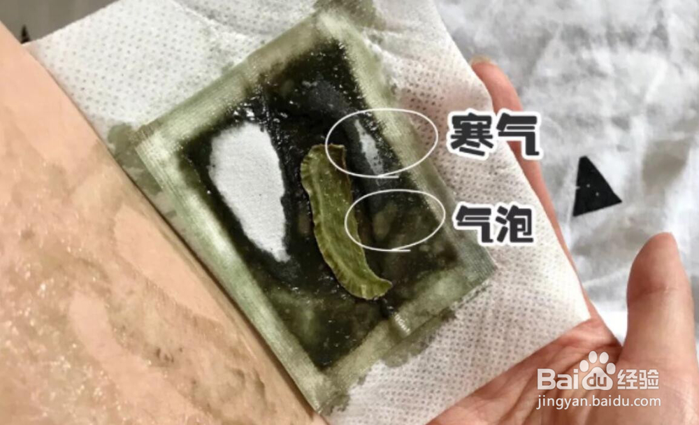 脚底贴中药贴真的有用吗