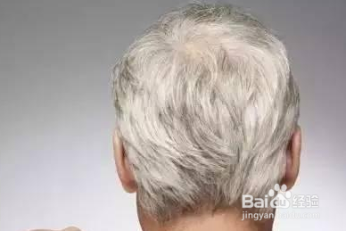 白头发和身体的关系