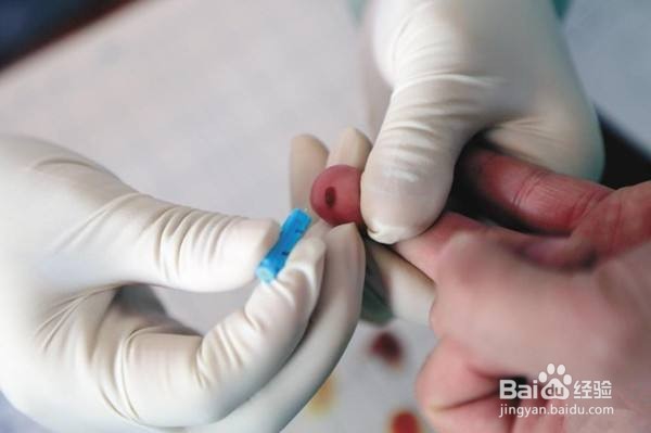 无偿献血的过程是怎么样的-今日献血