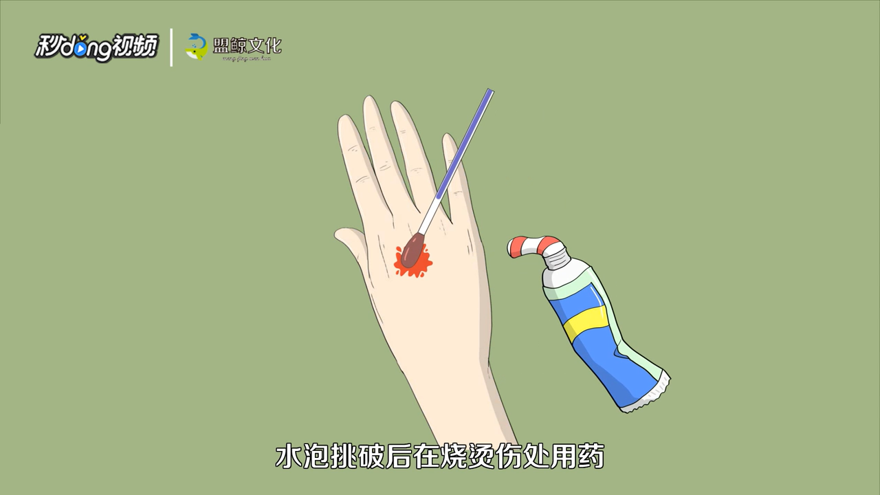 烫伤怎么处理
