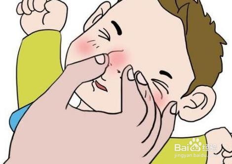 如何判断是否为过敏性鼻炎