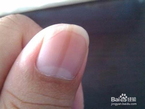 从你的手指头就可以看出健康问题!准爆!