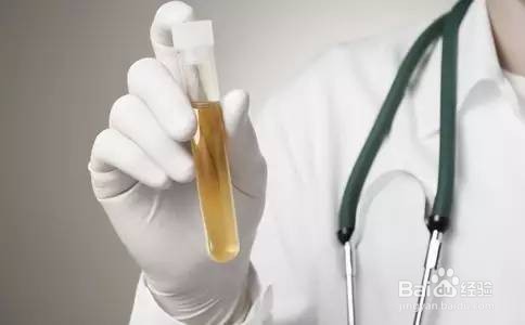 征兵体检前一天注意事项