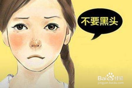 脸上的黑头怎么去除