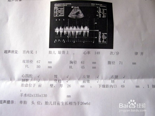 胎儿B超图详解