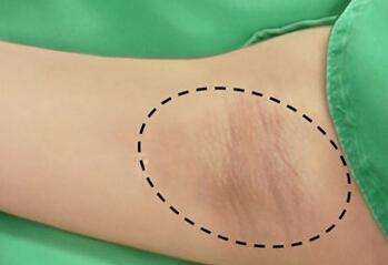 怎么遮掩狐臭？