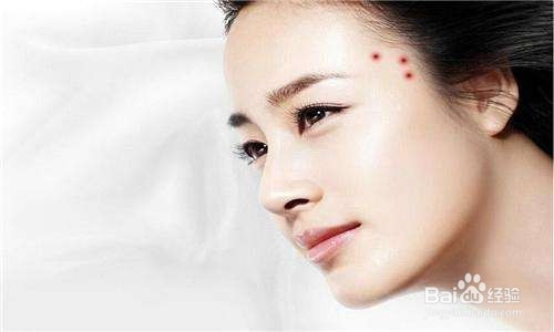 长痘痘的原因及调理方法