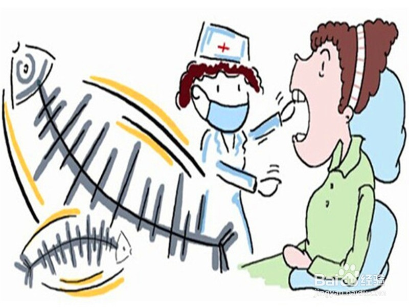 鱼刺卡喉咙需要注意事项以及该如何