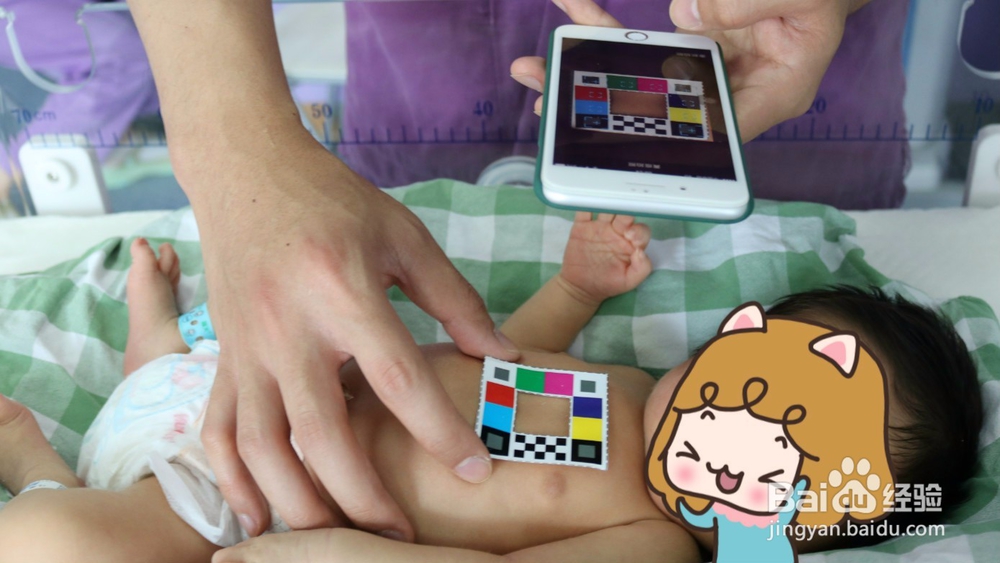 怎么用哪吒保贝APP检测宝宝黄疸?