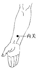 百病刮痧：[40]妊娠恶阻的刮痧疗法