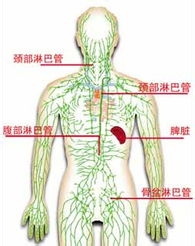 教你怎样抗衡淋巴癌