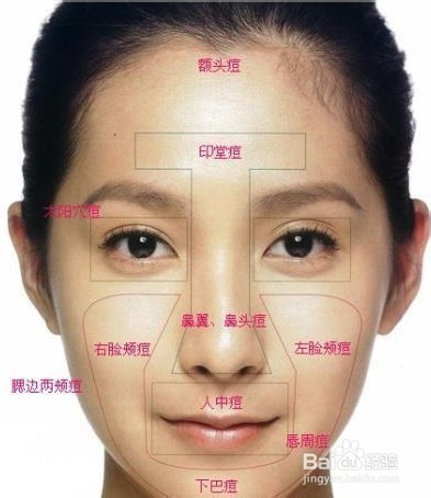 了解自己脸上的某个部位长痘痘的原因