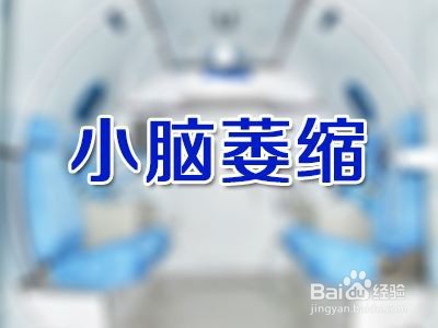 温补祛萎汤你需要了解