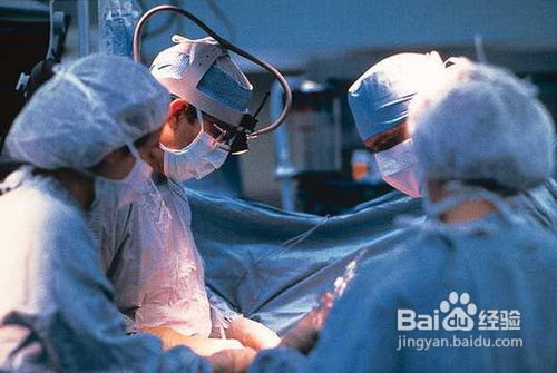 静脉曲张怎么治？