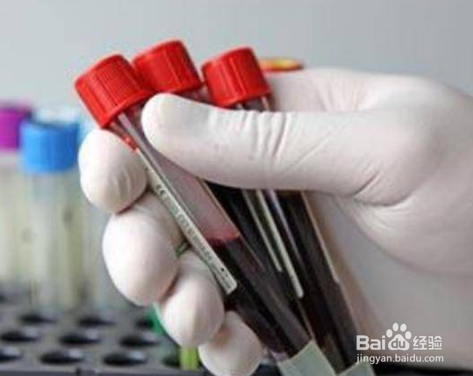 血型影响腹泻的严重程度