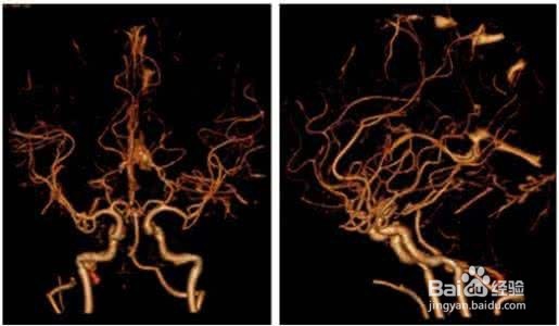 CTA认证的简介跟流程