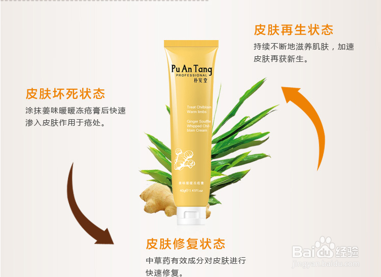 防治冻疮的方法