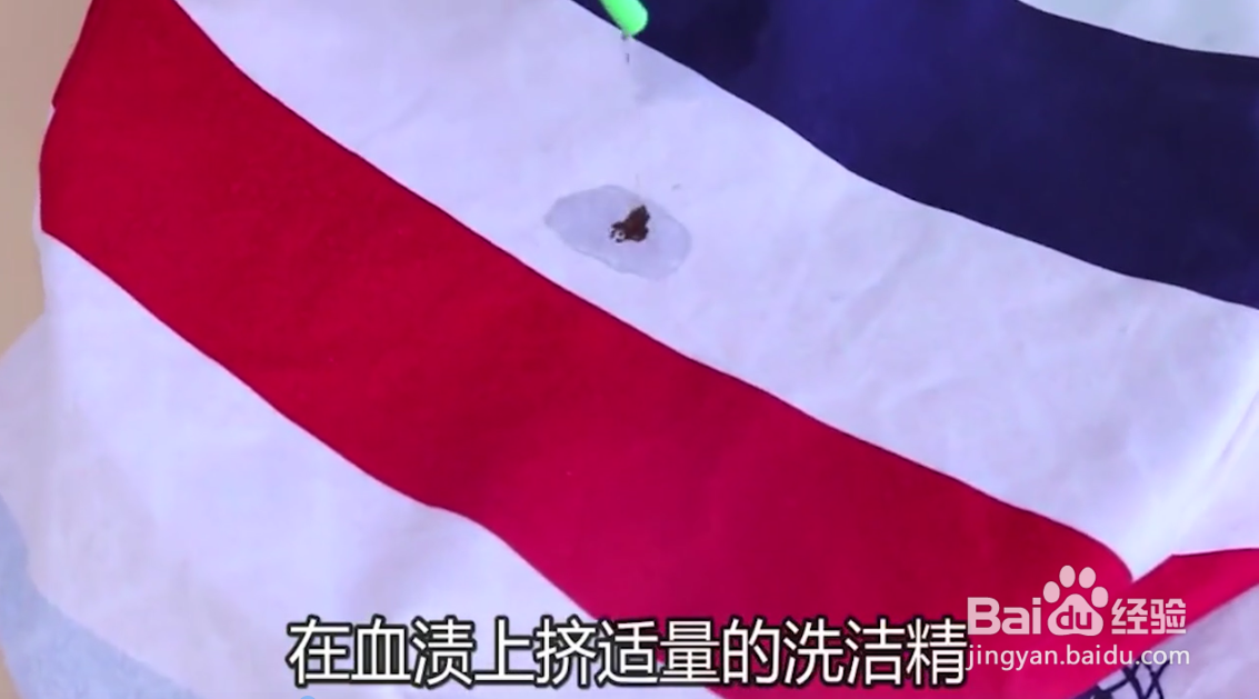 如何有效清洗床单上的血迹