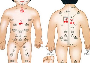 三伏贴 儿童也能贴