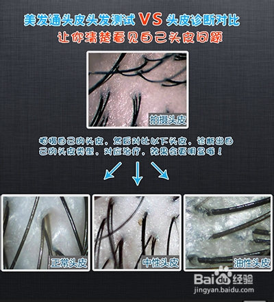 美发通教程之头皮头发诊断新手版